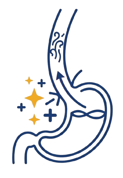 Acid Reflux